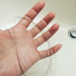 引きこもりは薄毛やハゲる危険性あり!?ハゲないために注意したい事