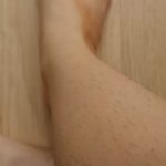 ムダ毛処理後のチクチクをなんとかしたい!つるすべ肌を維持できる方法